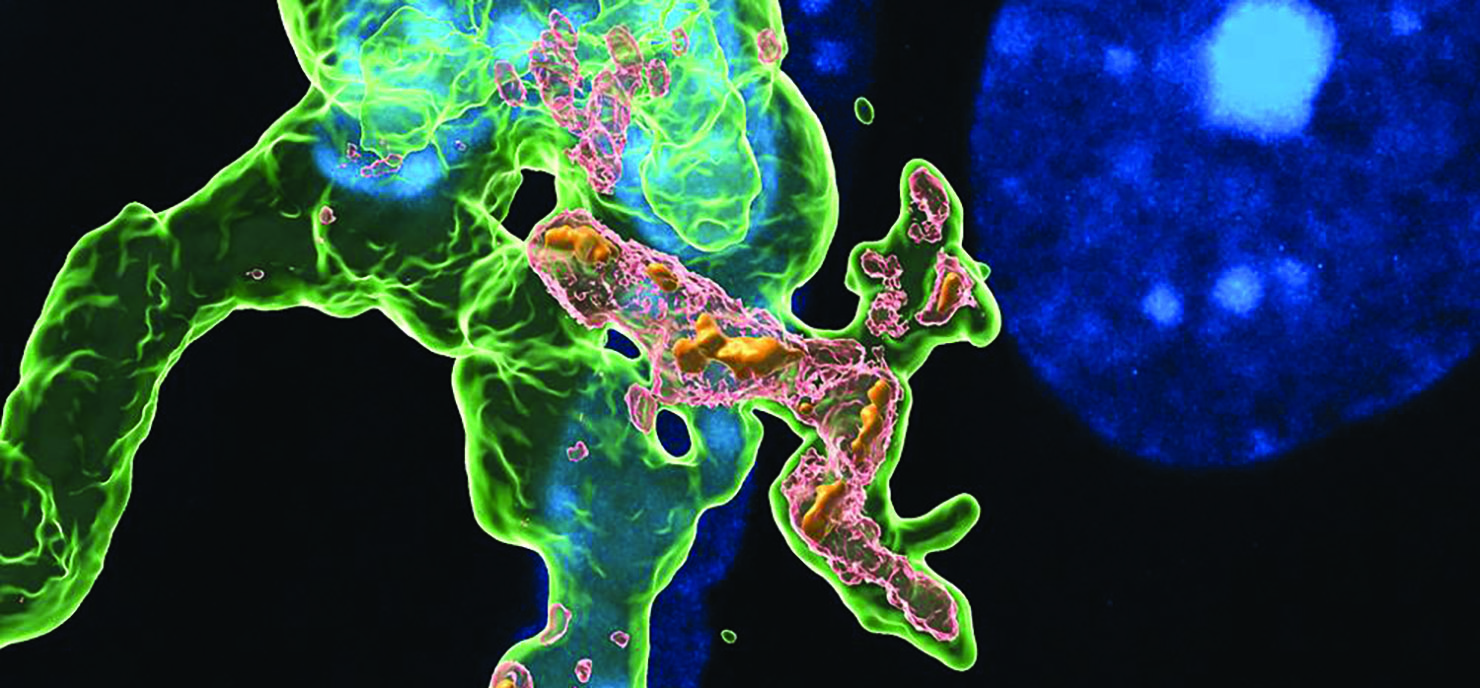 Research sheds new light on Parkinsons’ disease origin