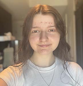 Taylor Prince, Canada Student Merit Award Winner 2025